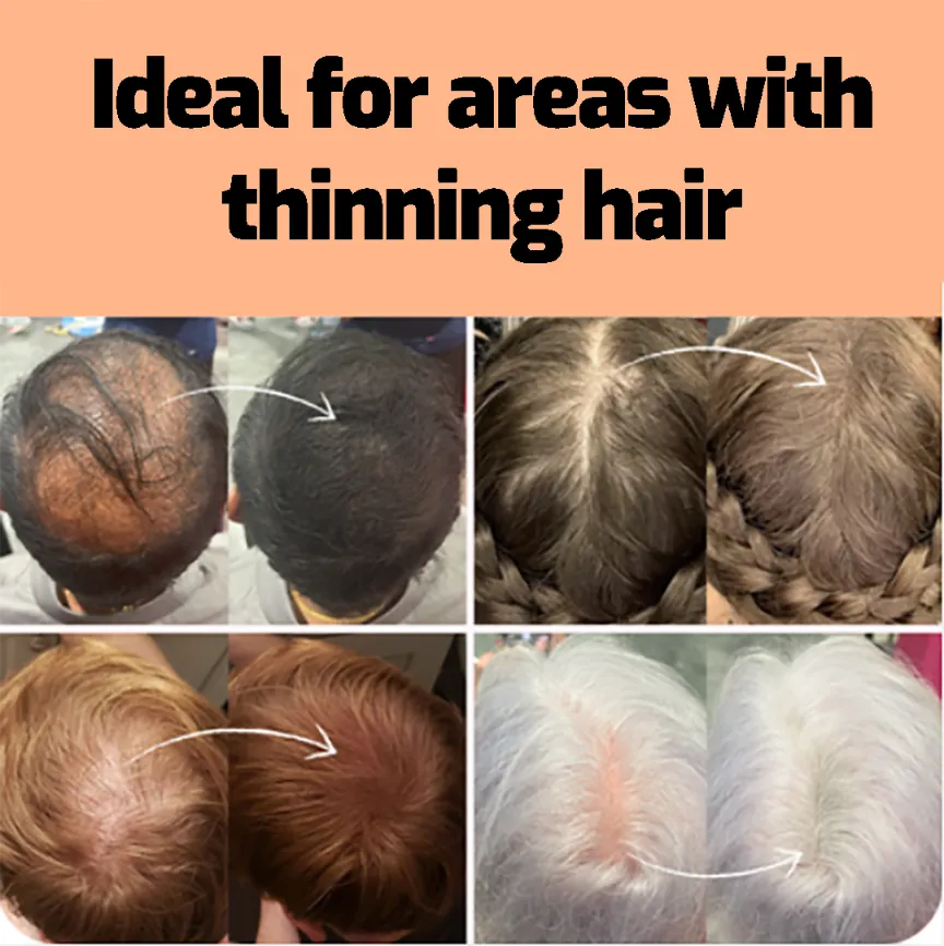 QAZAMI 5 g hair fibers